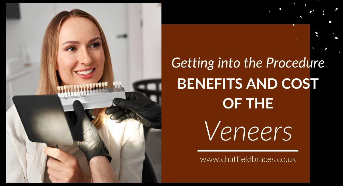 Getting into the Procedure, Benefits and Cost of the Veneers
